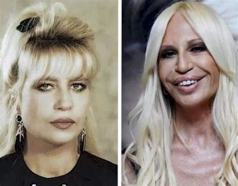 donatella versace mode|donatella versace face what happened.